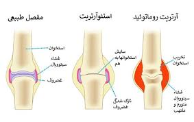 پاورپوینت استیوارتریت